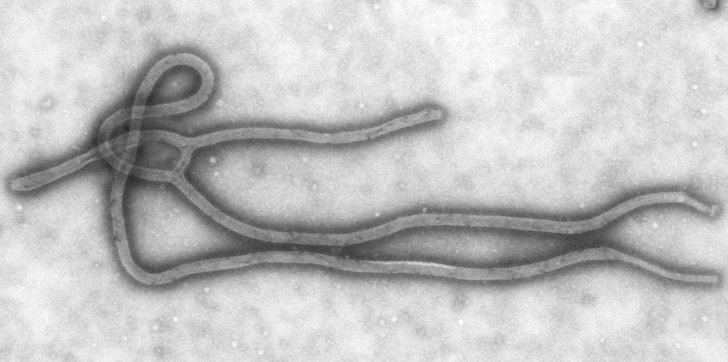 Изображение вируса Эбола под электронным микроскопом
