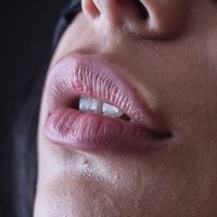 Иллюстрация к статье Что такое гиалуроновые усы и как от них избавиться