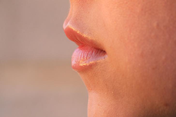 Лечение трещин в уголках рта